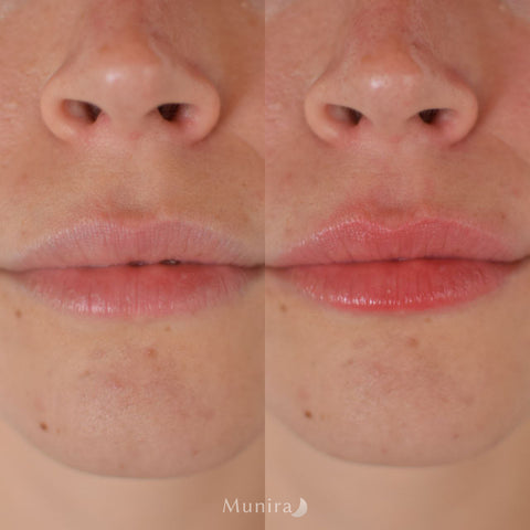 Velvet Lips Bliss - Siero labbra rimpolpante istantaneo e primer ad idratazione profonda✨